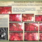 eposterhpvendo11